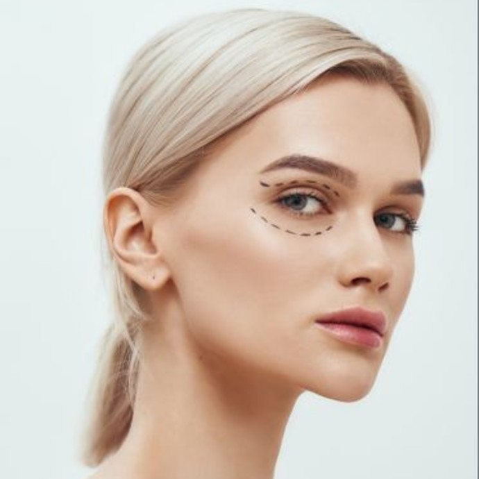 كل ما يجب معرفته حول جراحة الجفون Blepharoplasty