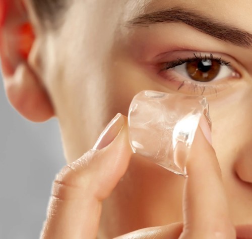 مكعّبات الثلج، هل هي فعّالة في التخفيف من مشاكل البشرة؟