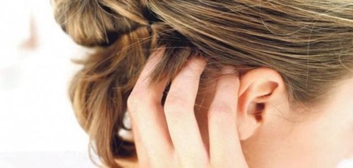 ما هي صدفية الشعر أسبابها وطرق معالجتها Ellearabia