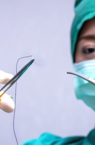 إبتكار خيوط جراحية ذكية تراقب التئام الجروح