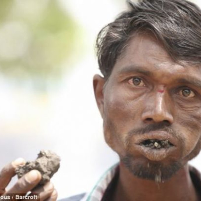 هندي مدمن على أكل الحجارة والطوب!