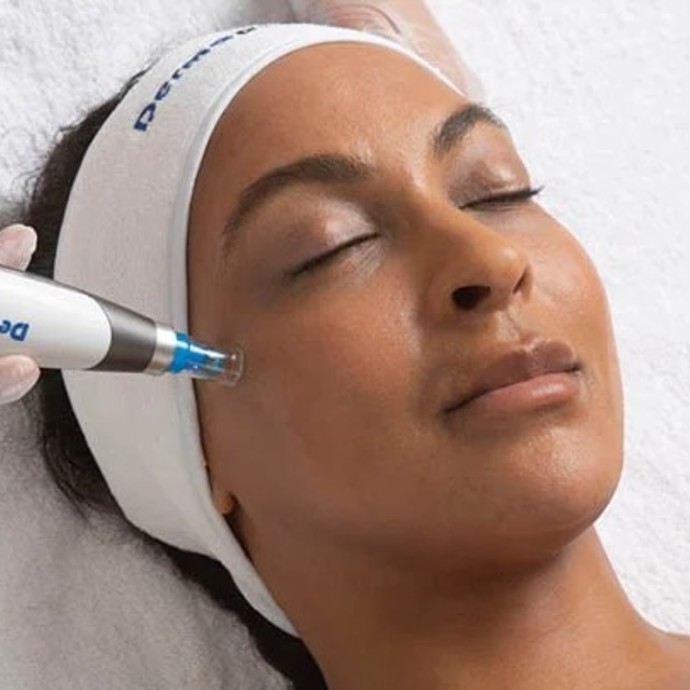 المايكرونيدلنج: كل ما تودين معرفته عن هذا الإجراء التجميلي