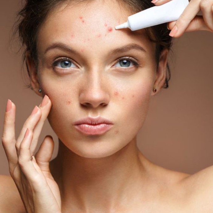 6 علاجات طبيعية للوقاية من بثور الوجه