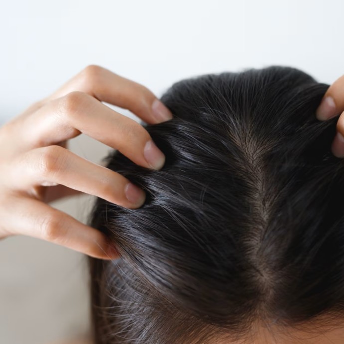 لماذا يزداد جفاف فروة الرأس وتهيّجها في الشتاء وما هو الحلّ؟