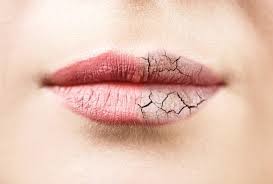 6 أسباب شائعة لجفاف الفم