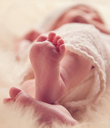 بالفيديو:ولادة طفلة بفمين منفصلين