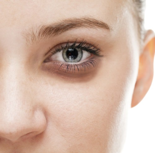 كيفية إزالة الهالات السوداء حول العينين