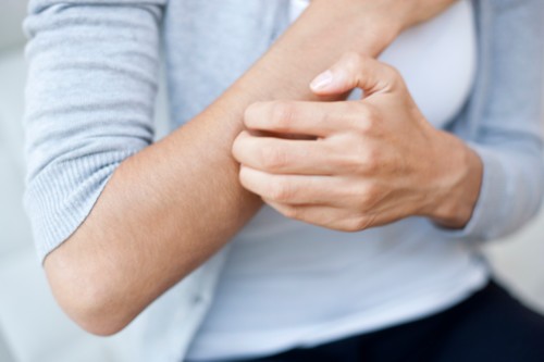 5 علاجات منزلية سهلة وسريعة للحساسية الجلدية