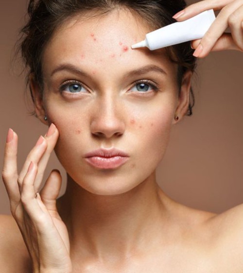 6 علاجات طبيعية للوقاية من بثور الوجه