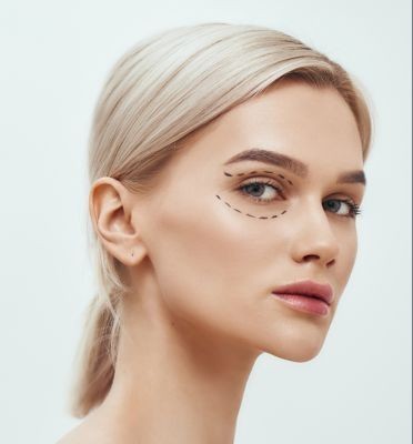 كل ما يجب معرفته حول جراحة الجفون Blepharoplasty
